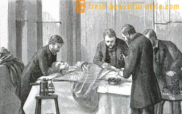 Fapte șocante despre o intervenție chirurgicală victoriană