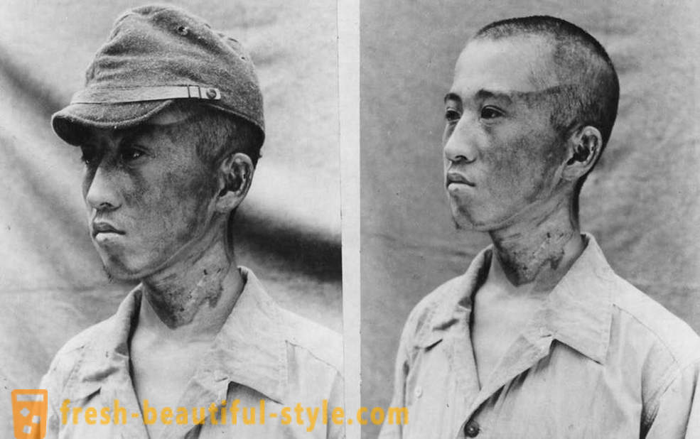 Fotografii istorice descurajante Hiroshima