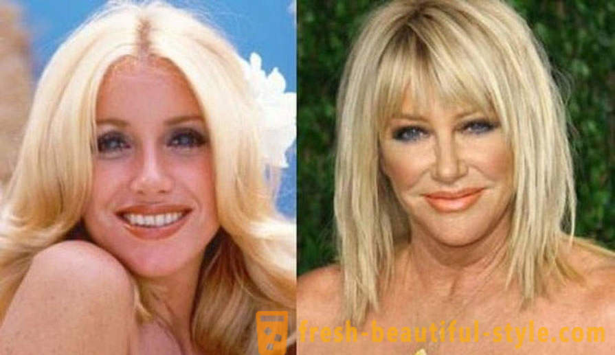 15 celebrități, terminat prost cu Botox