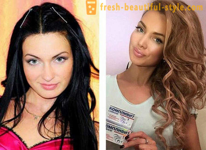 10 frumusețile rusești înainte și după plastic