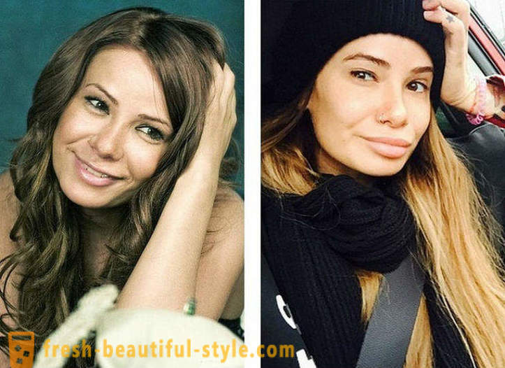 10 frumusețile rusești înainte și după plastic
