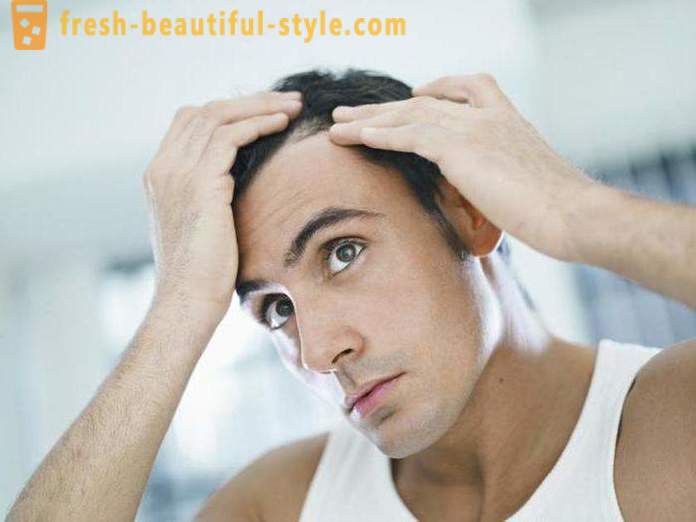 Medicamente cu minoxidil pentru păr: comentarii, caracteristici și descrierea aplicării cele mai bune