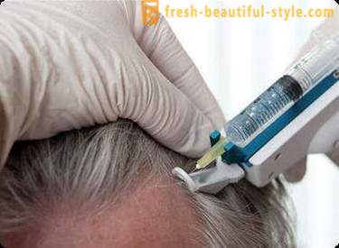 Mezoterapie pentru păr: instrumente de machiaj și contraindicații